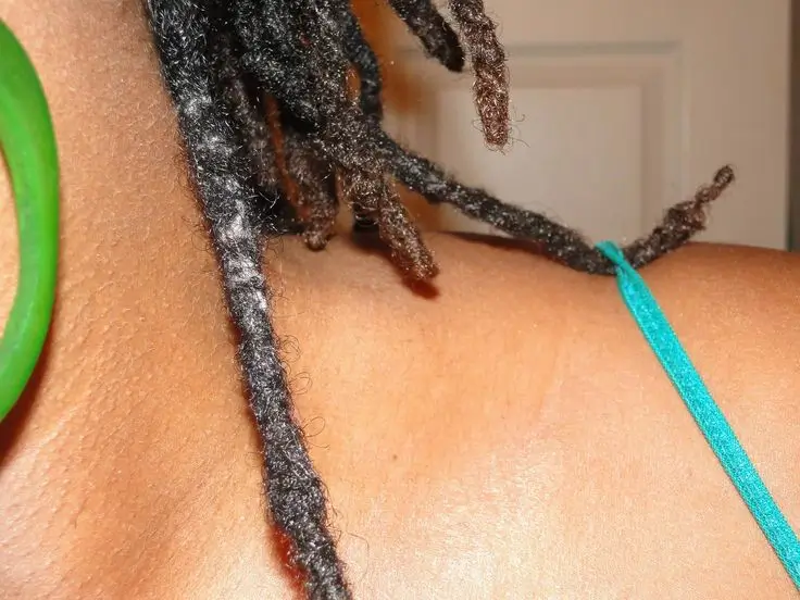 What causes lint in locs